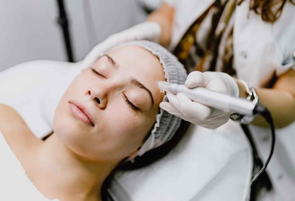 Microneedling Behandlung bei MediBeauty nahe St. Gallen